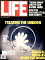 LIFE830401.gif 4/1/1983 Patients before birth - Image 1
