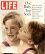 4/1/1996 Conjoined twins