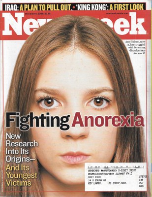 12/05/2005 12/05/200 5 Anorexia